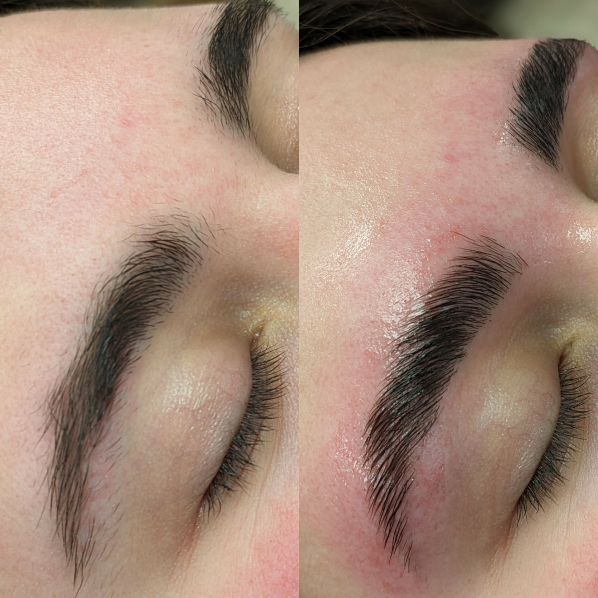 Beauty treatment 01