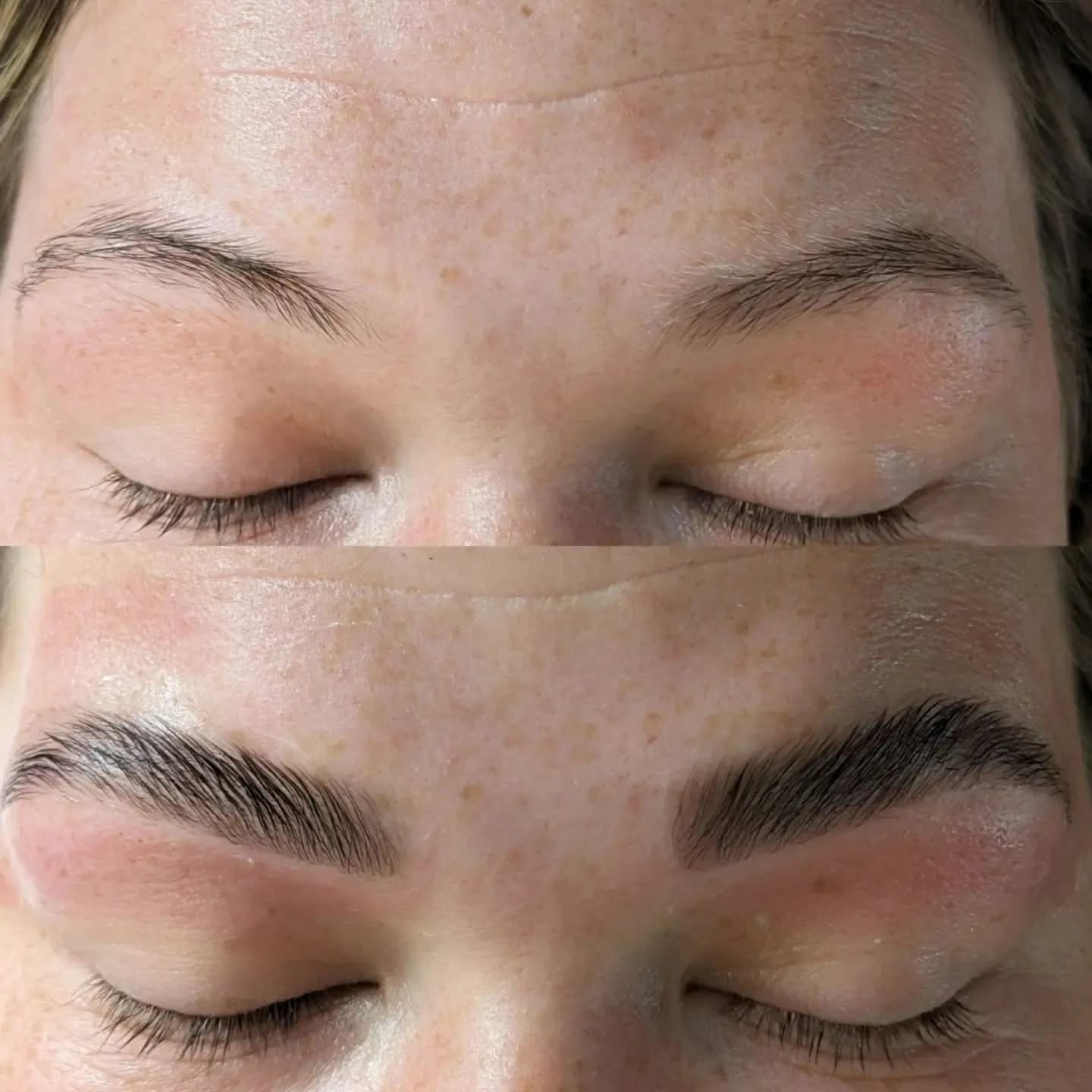 Beauty treatment 05
