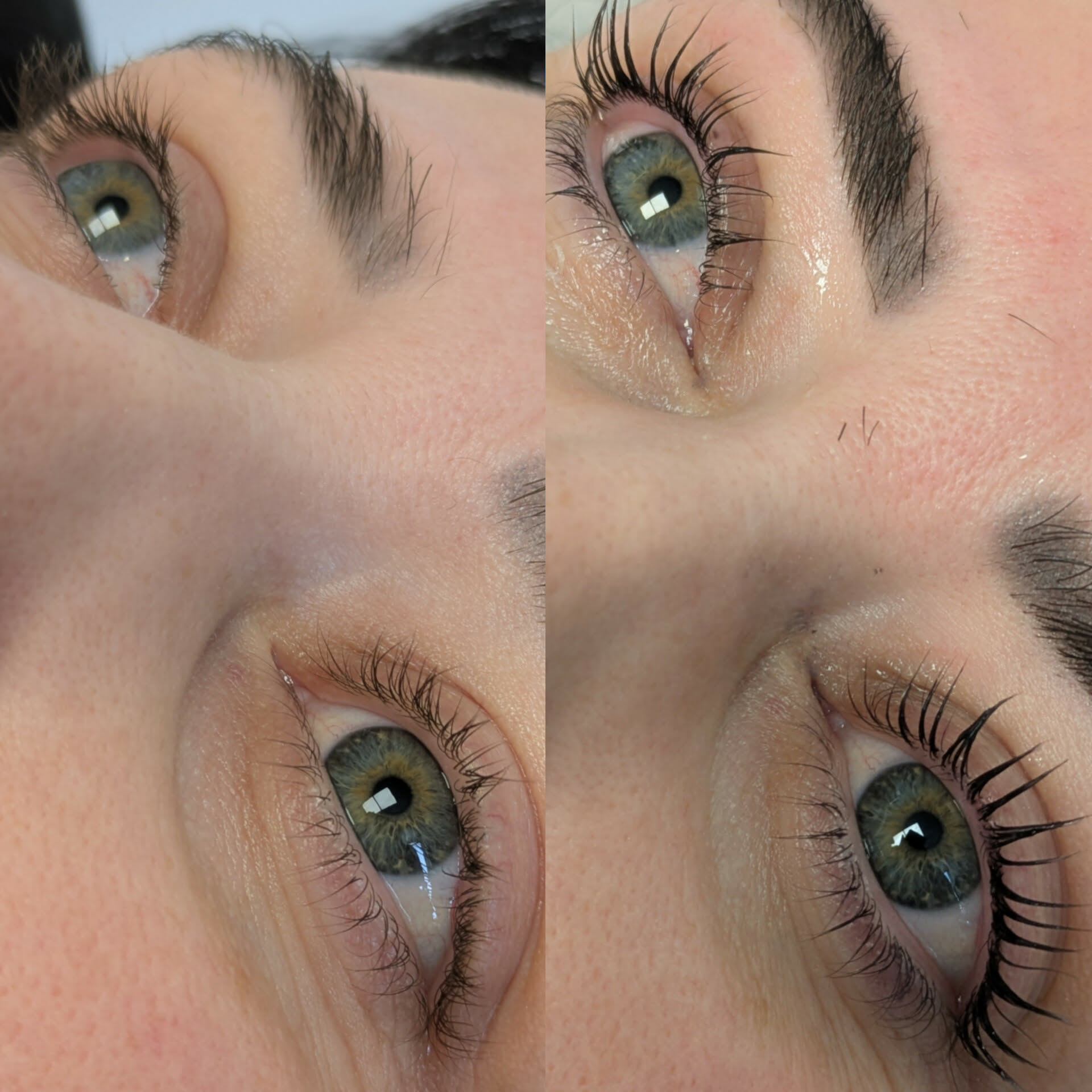 Beauty treatment 09