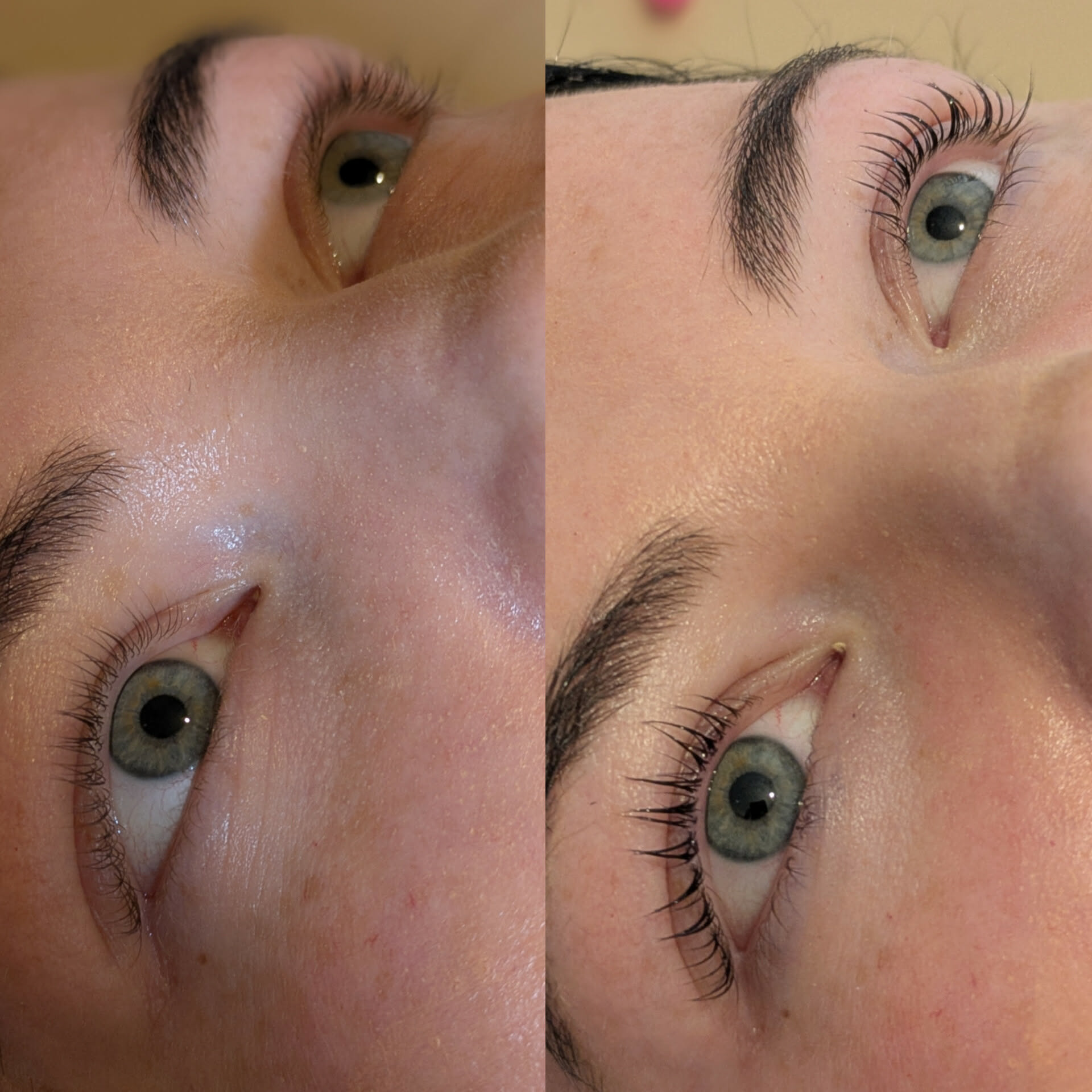 Beauty treatment 10