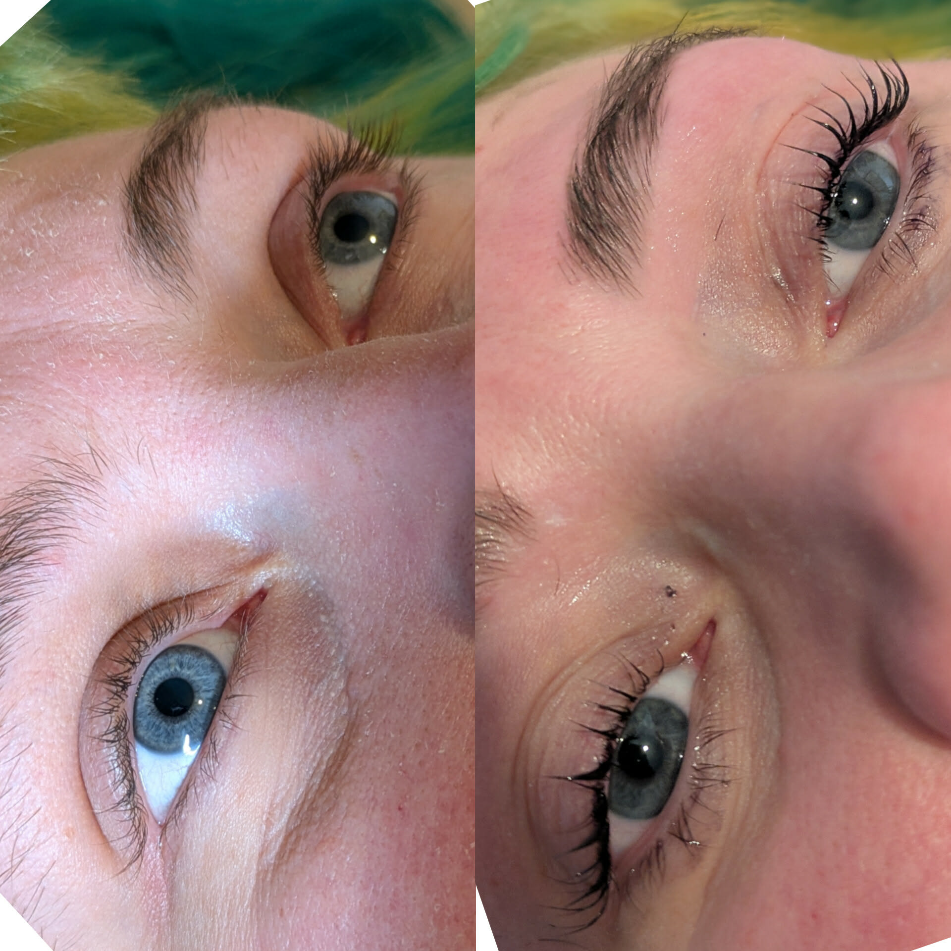 Beauty treatment 16